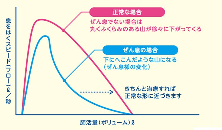 気道の図解